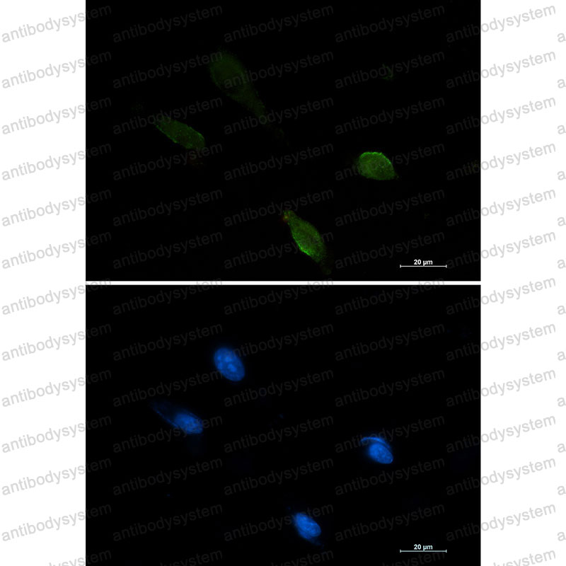 Anti-IRF1 Antibody (R1N19)