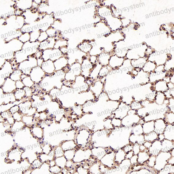 Anti-HAPLN1 Antibody (R1B05)