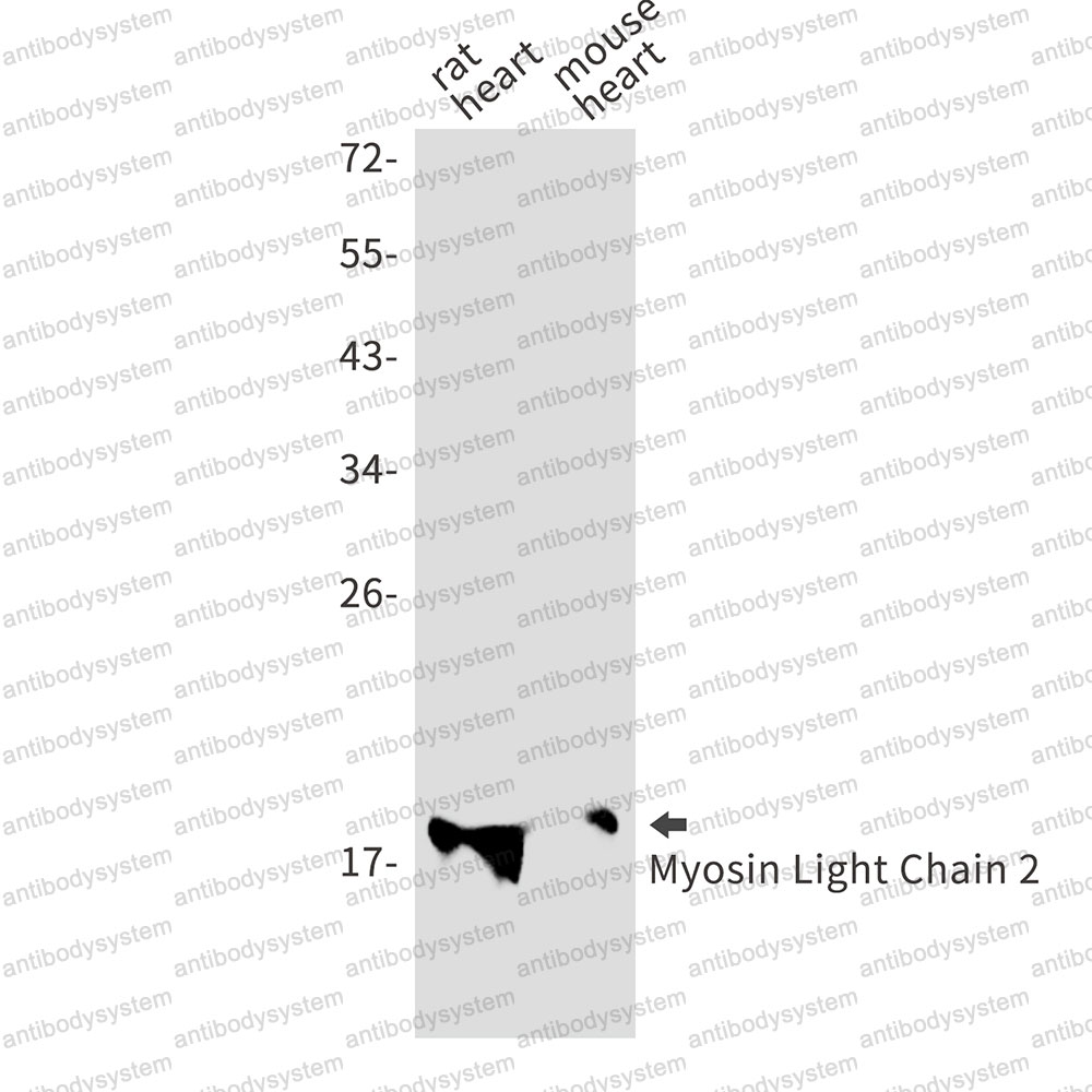 Anti-MYL2 Antibody (R1N20)