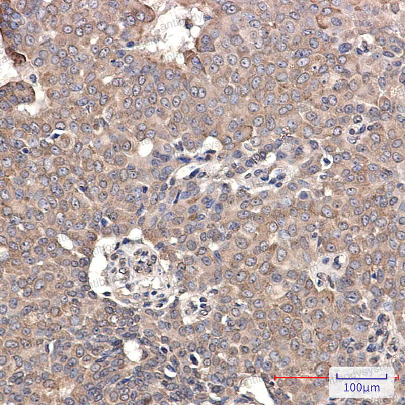 Anti-GRP78/HSPA5 Antibody (R1N21)