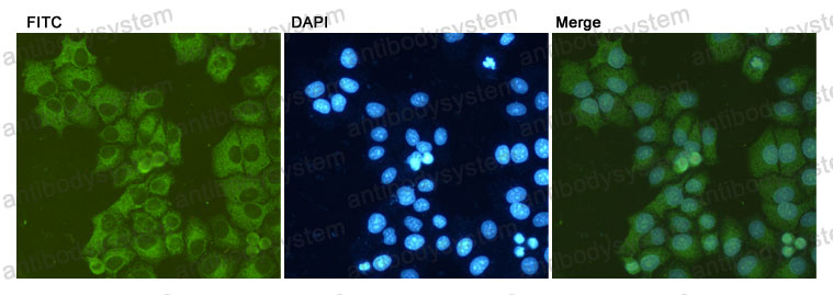 Anti-GRP78/HSPA5 Antibody (R3C38)
