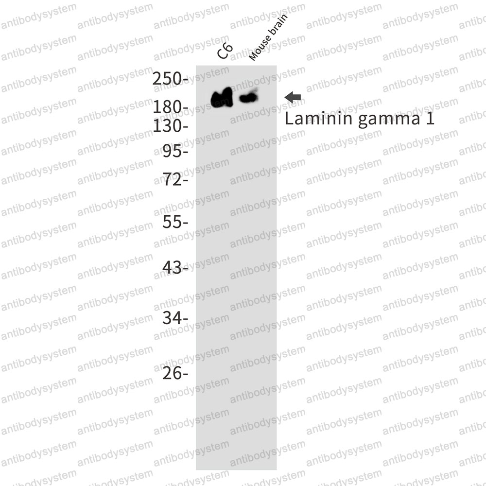 Anti-LAMC1 Antibody (R1N23)