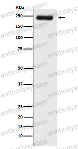 Anti-LAMC1 Antibody (R1N22)