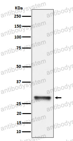 Anti-PNMT Antibody (R1A47)