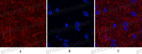 Immunofluorescence for Anti-MAP2 Antibody (R3C43) ?>