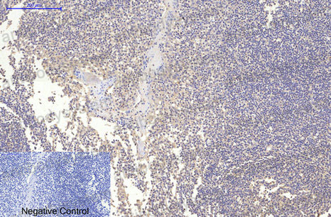 Immunohistochemical for Anti-MAP2 Antibody (R3C43) ?>