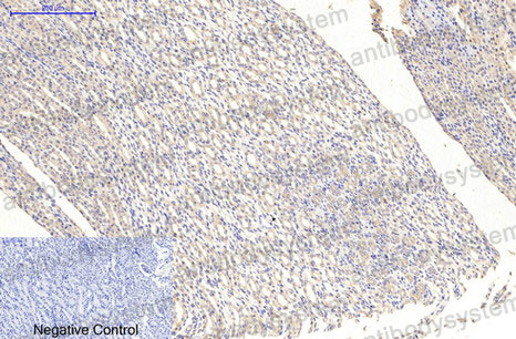 Immunohistochemical for Anti-MAP2 Antibody (R3C43) ?>
