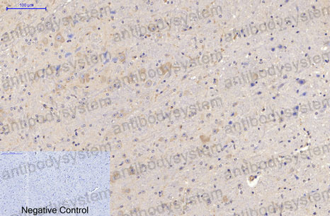 Immunohistochemical for Anti-MAP2 Antibody (R3C43) ?>