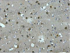 Immunohistochemical for Anti-MAP2 Antibody (R3C43) ?>