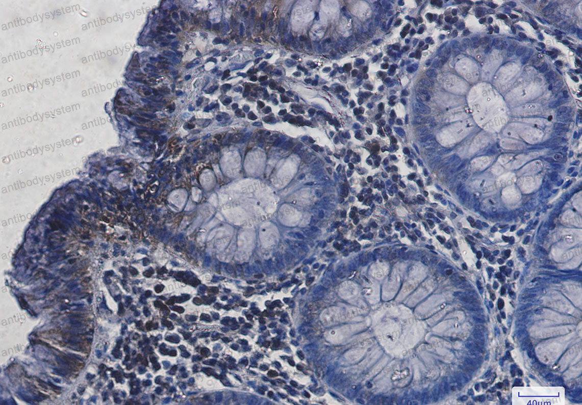 Anti-HSPA8 Antibody (R1N24)
