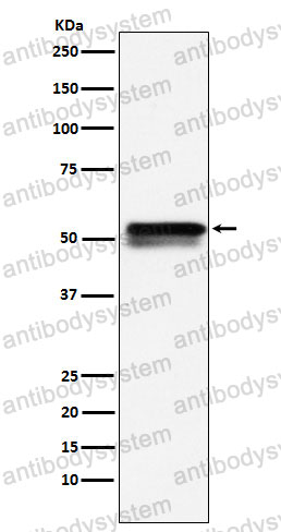 Anti-EGR2 Antibody (R1N25)