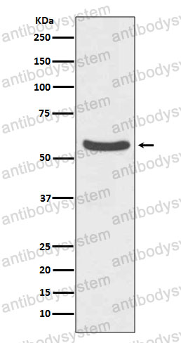 Anti-SLC2A2 Antibody (R1N26)