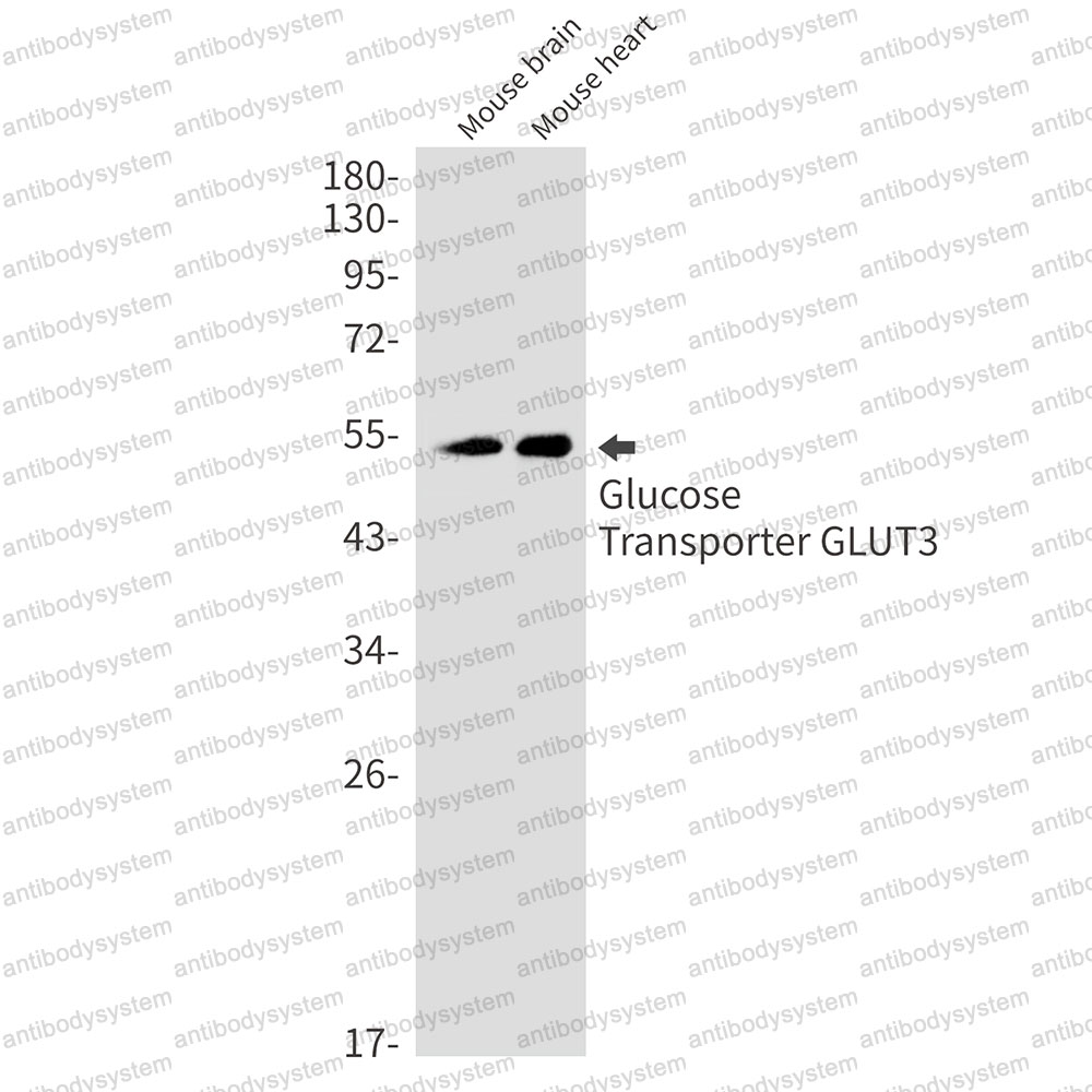 Anti-SLC2A3 Antibody (R1N28)