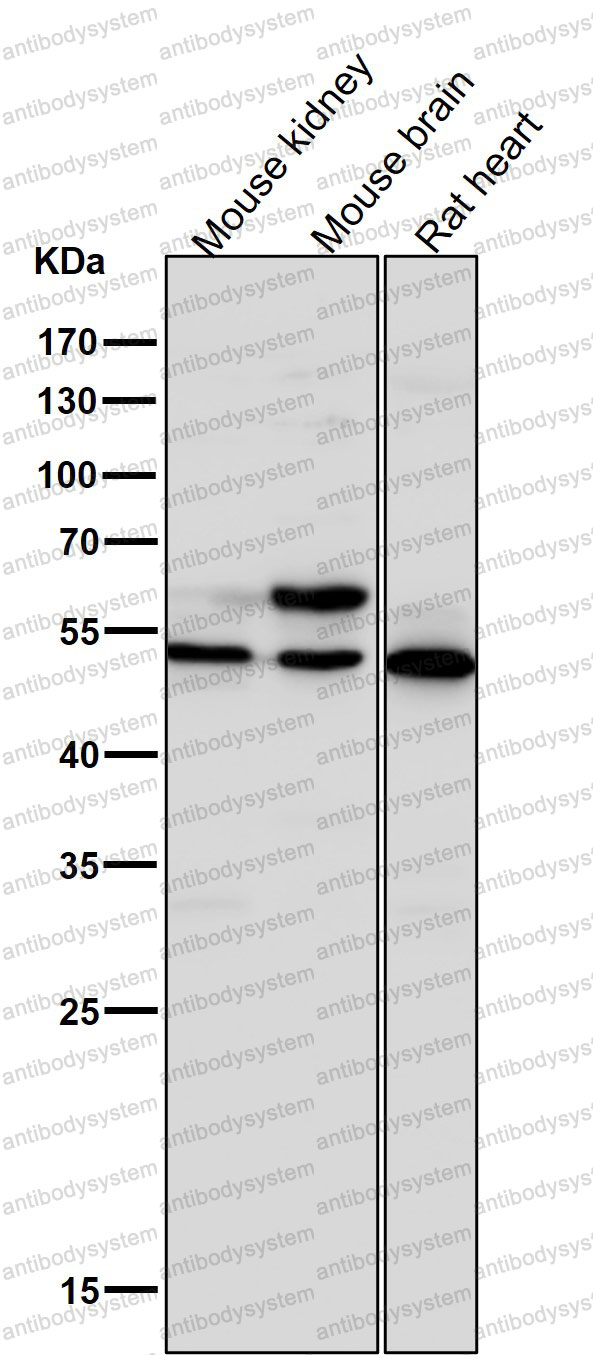 Anti-SLC2A3/GLUT3 Antibody (R1N27)