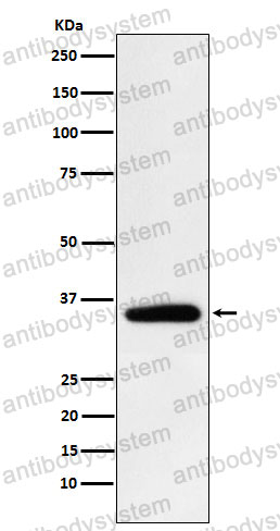 Anti-PDHB Antibody (R1N29)