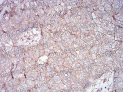 Immunohistochemical for Anti-RALA Antibody (R3C51) ?>