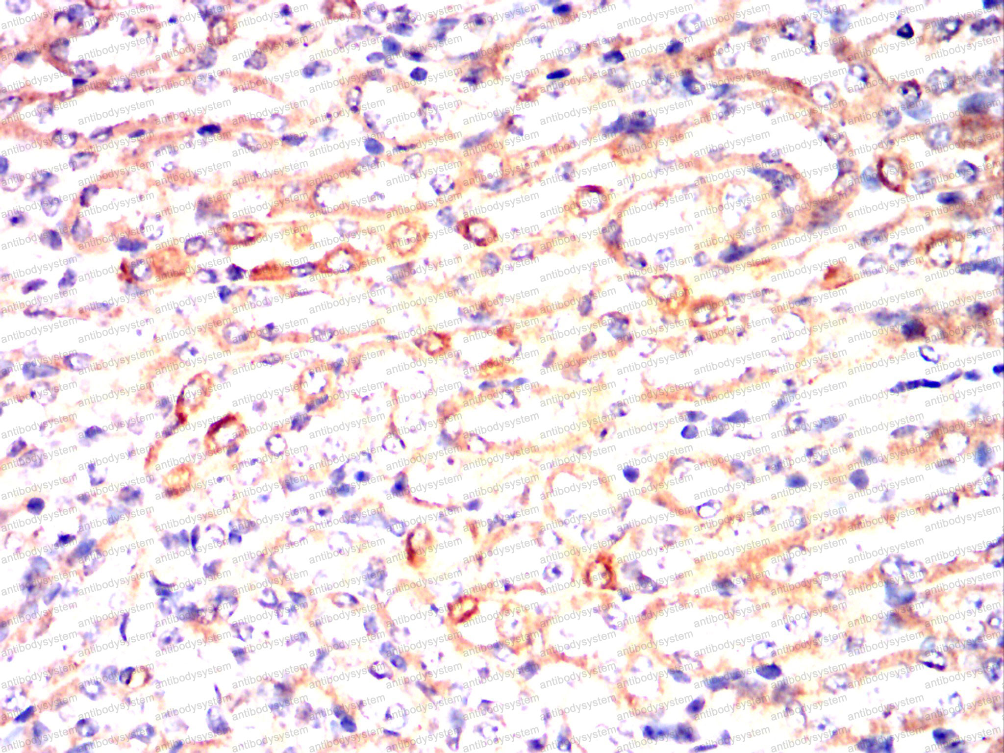 Immunohistochemical for Anti-RALA Antibody (R3C51) ?>