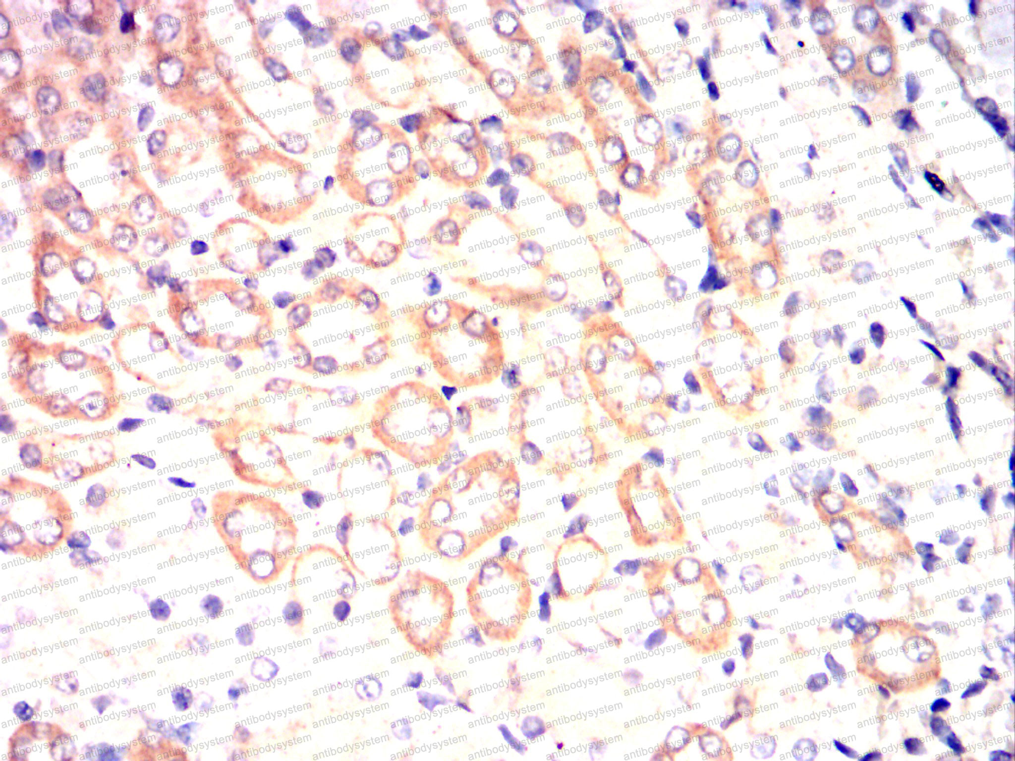 Immunohistochemical for Anti-RALA Antibody (R3C51) ?>