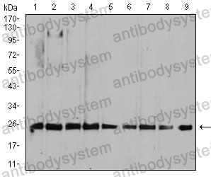 Western blot for Anti-RALA Antibody (R3C51) ?>