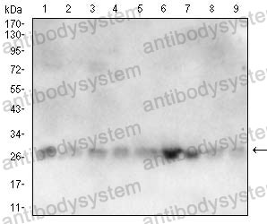 Western blot for Anti-RALA Antibody (R3C51) ?>