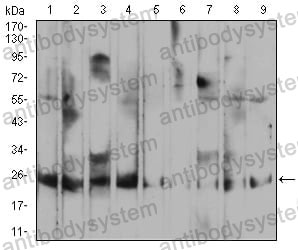 Western blot for Anti-RALA Antibody (R3C50) ?>
