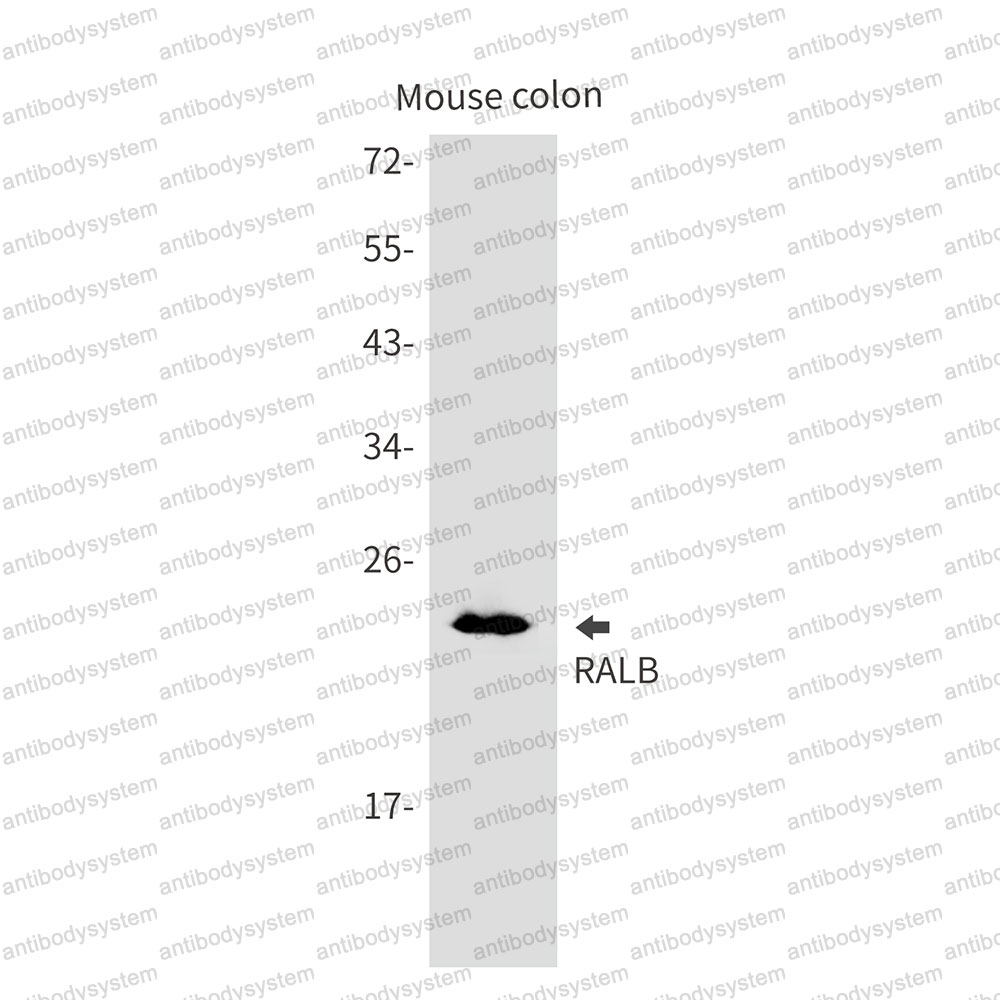 Anti-RALB Antibody (R1N31)