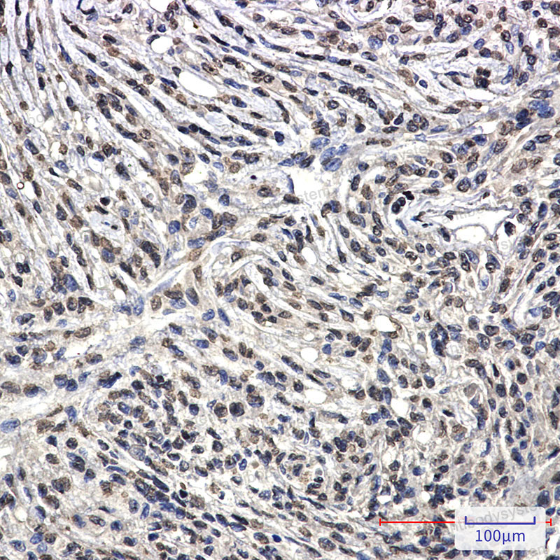 Anti-BCR Antibody (R1N32)