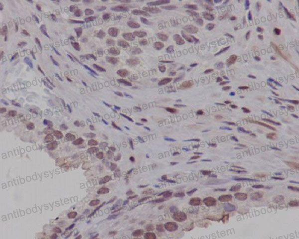 Anti-PIM1 Antibody (R1C46)