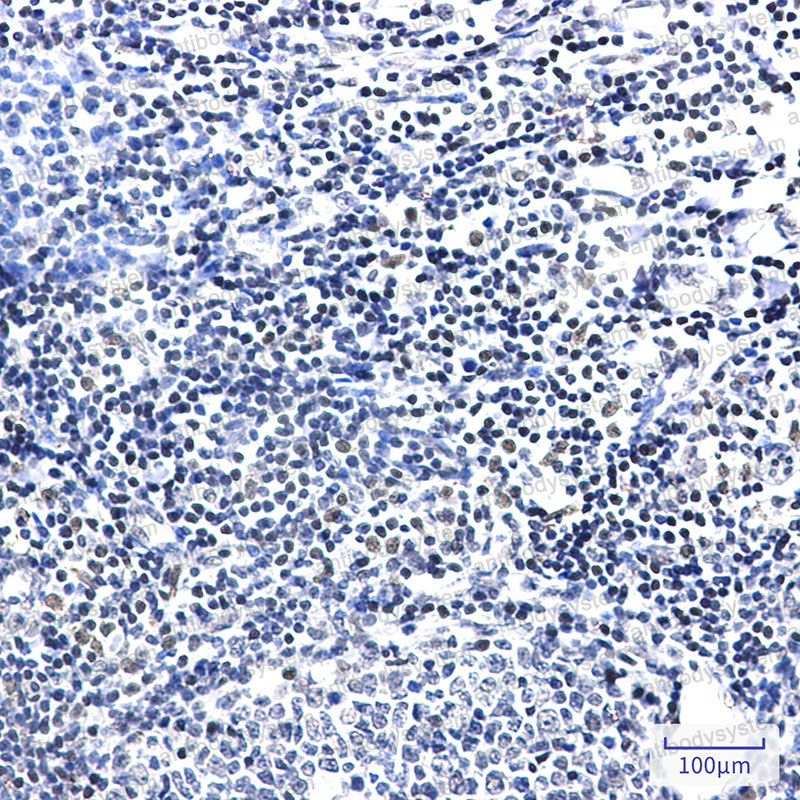 Anti-PIM1 Antibody (R1N34)