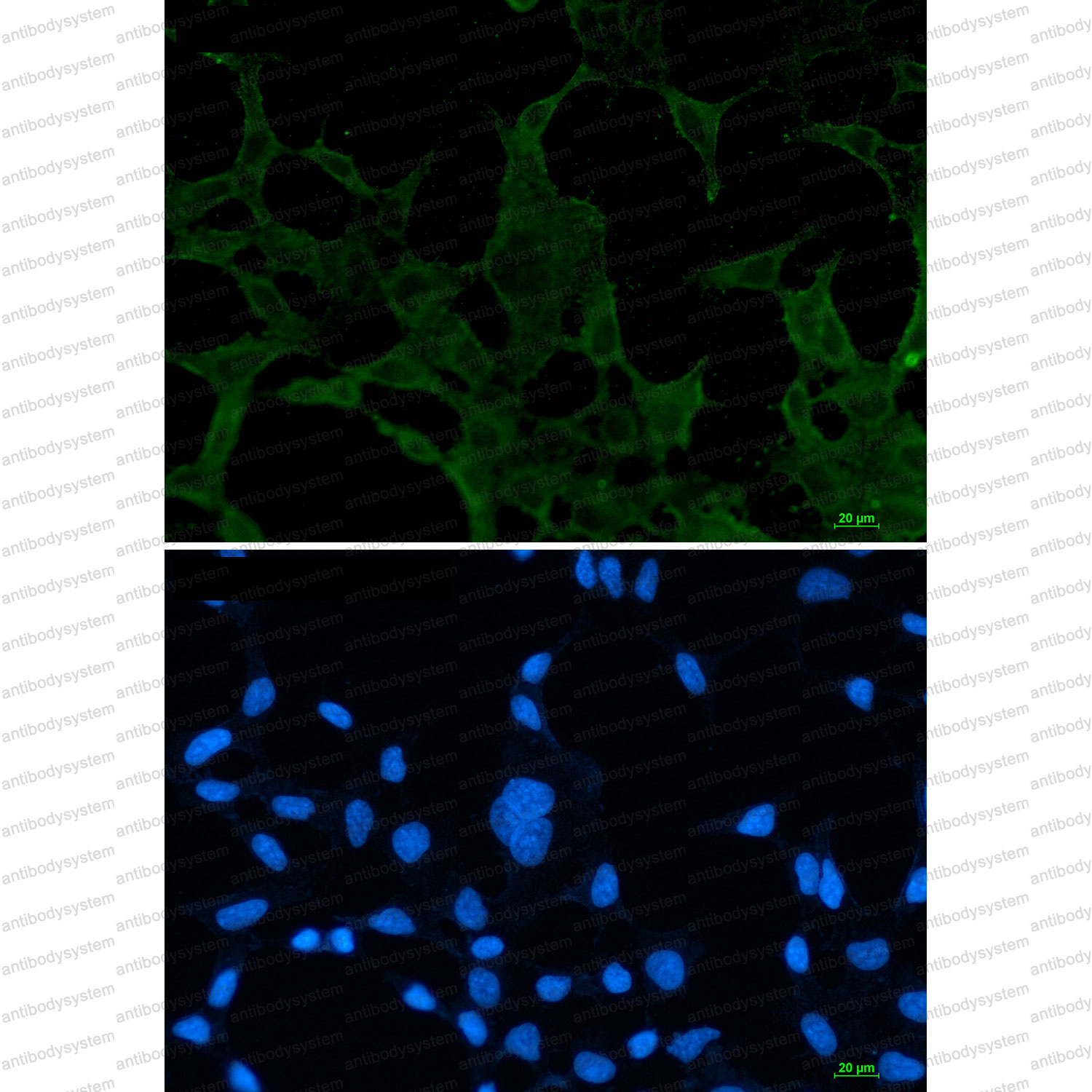 Anti-ACADM Antibody (R1N35)