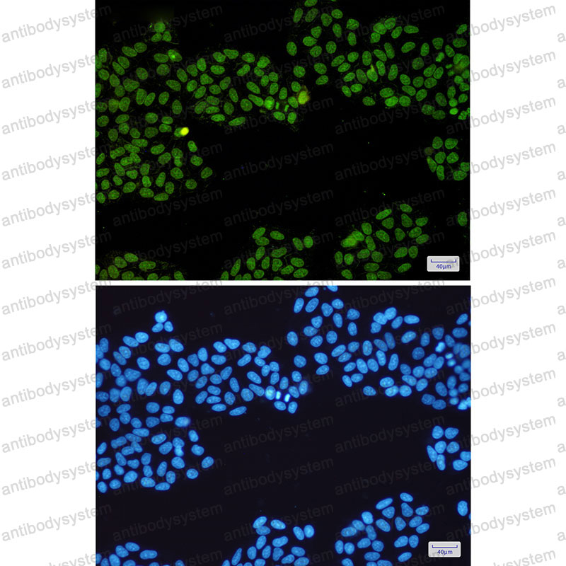 Anti-TOP1 Antibody (R1N36)