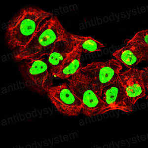 Immunofluorescence for Anti-TOP1 Antibody (R3C59) ?>
