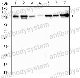 Western blot for Anti-TOP1 Antibody (R3C59) ?>