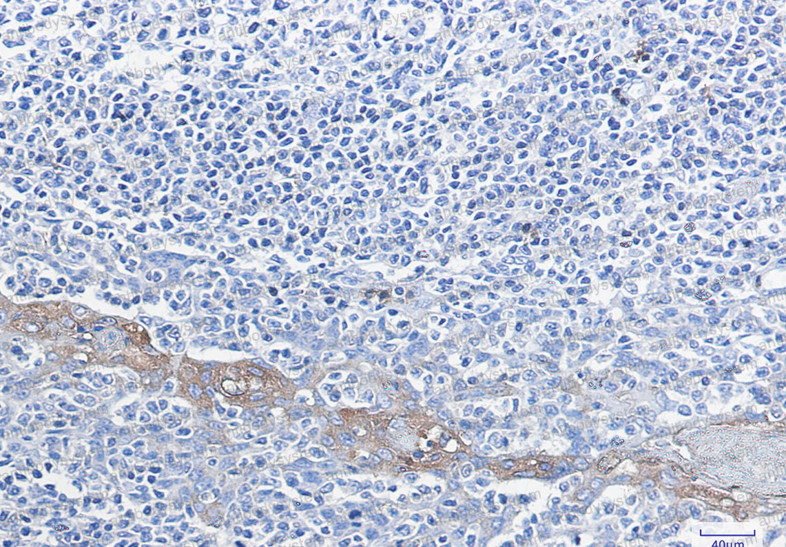 Anti-G6PD Antibody (R1N37)