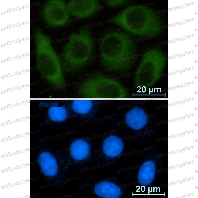 Anti-G6PD Antibody (R1N38)