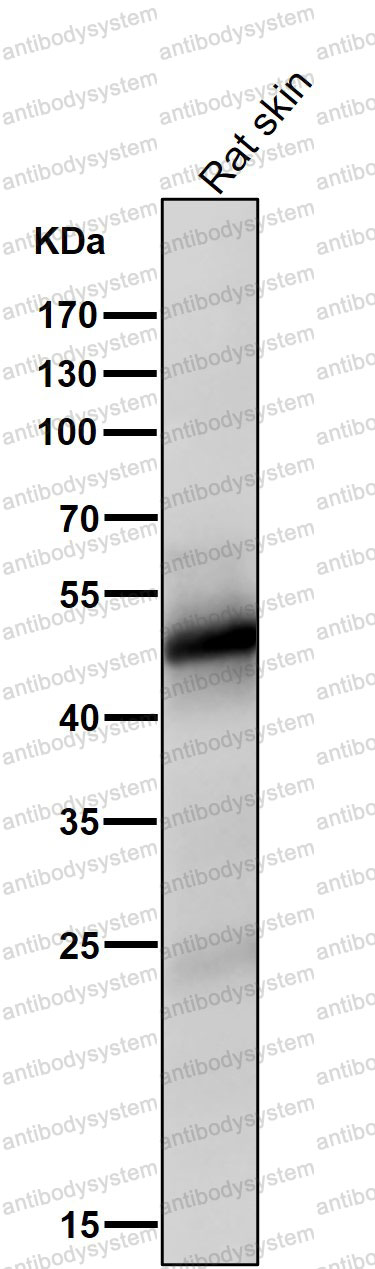 Anti-VDR Antibody (R1N39)