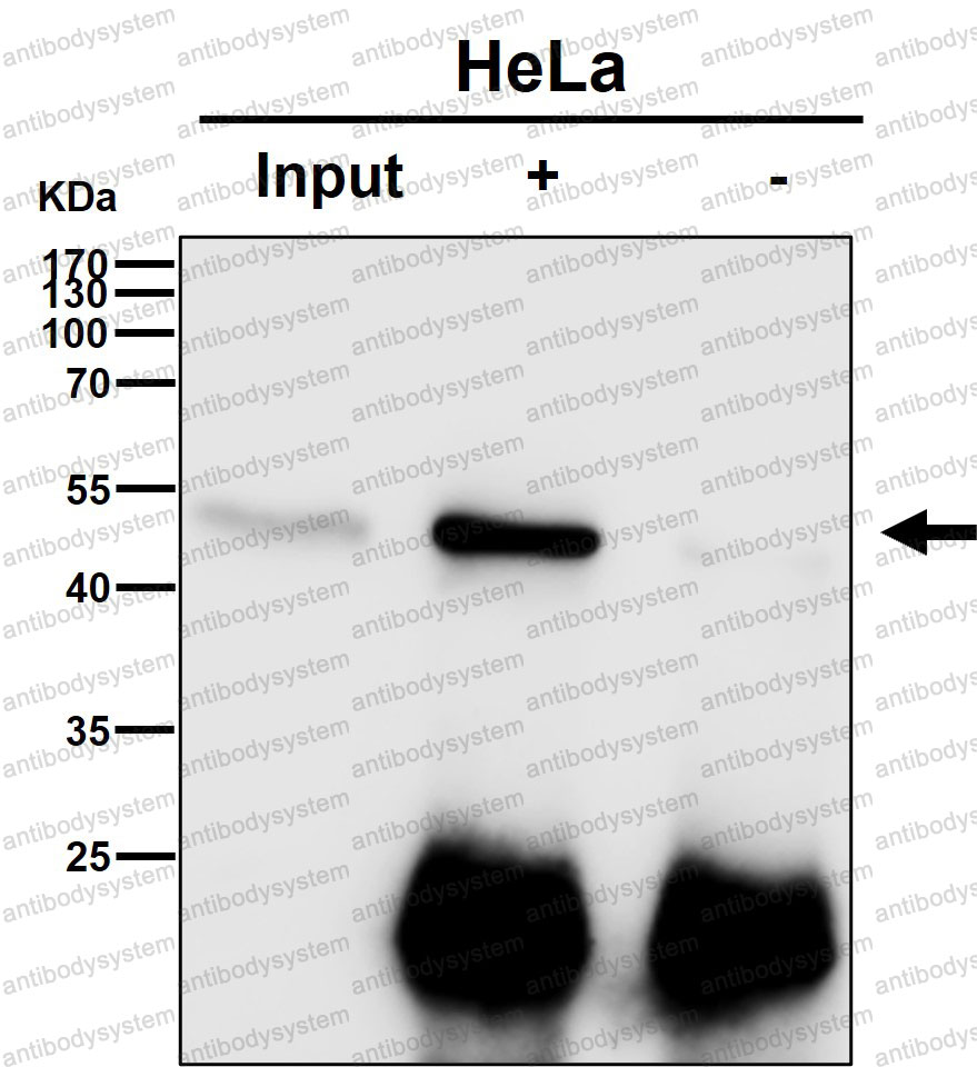 Anti-ESRRA Antibody (R1N40)