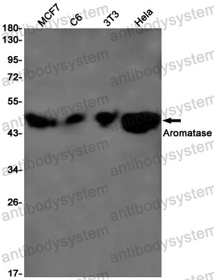 Anti-CYP19A1 Antibody (R1N43)