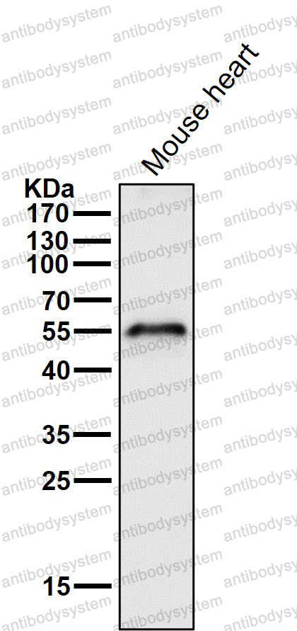 Anti-CYP19A1 Antibody (R1N42)