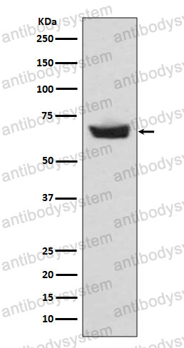 Anti-CETP Antibody (R1B23)