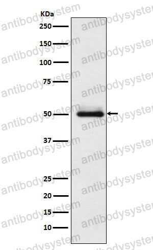 Anti-CYP2C9 Antibody (R1N45)