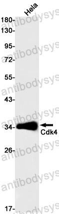 Anti-CDK4 Antibody (R1N49)