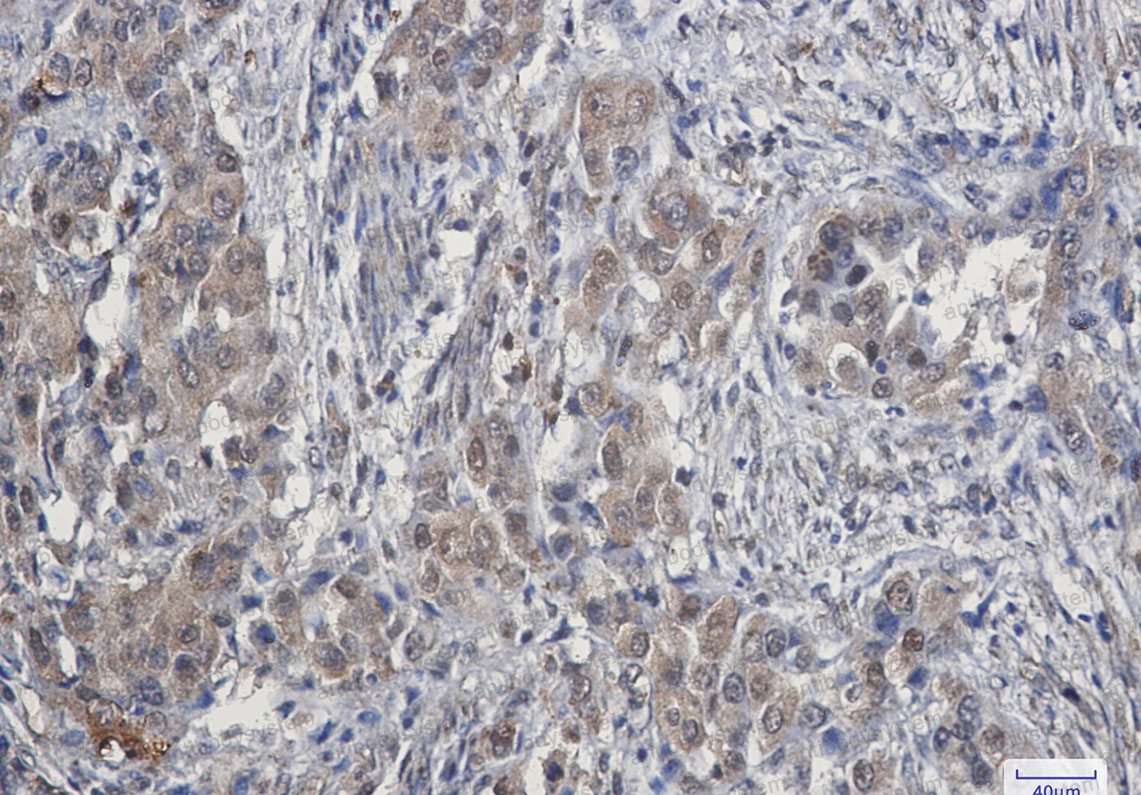 Anti-CDK4 Antibody (R1N48)