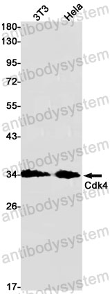 Anti-CDK4 Antibody (R1N47)