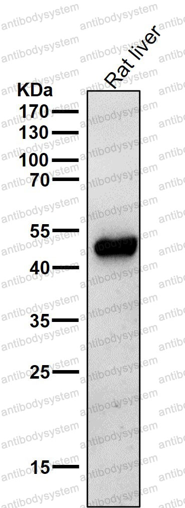 Anti-ODC1 Antibody (R1N51)