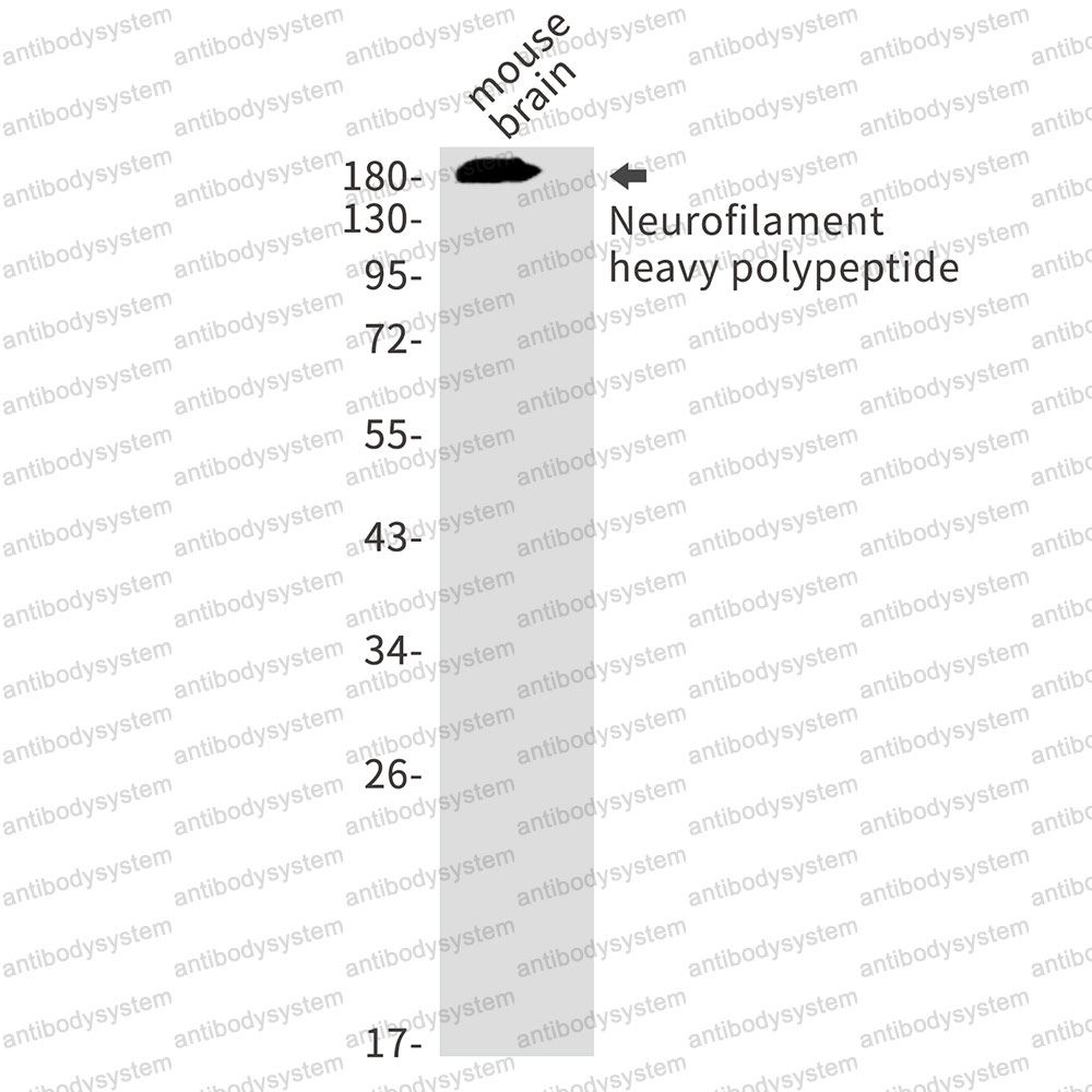 Anti-NEFH Antibody (R1N52)