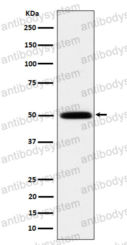 Anti-HARS1 Antibody (R1N53)