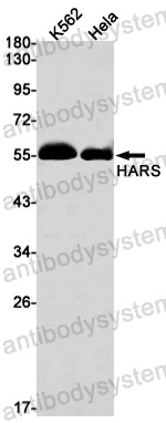 Anti-HARS1 Antibody (R1N54)