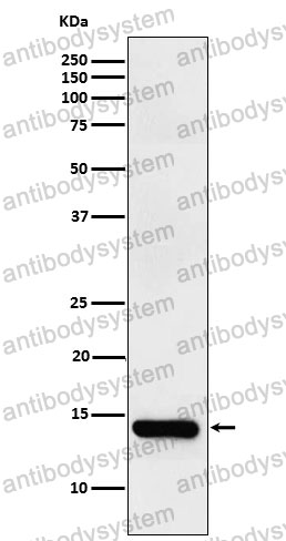 Anti-FABP2 Antibody (R1N55)