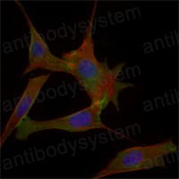 Immunofluorescence for Anti-FABP2 Antibody (R3C85) ?>